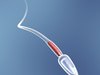 Sperm