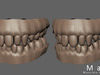 Teeth and gums  3D Model