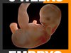 Human Embryo 6 Weeks 3D Model