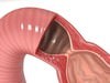 Realistic Stomach with Cutaway 3D Model .max .obj .3ds .fbx