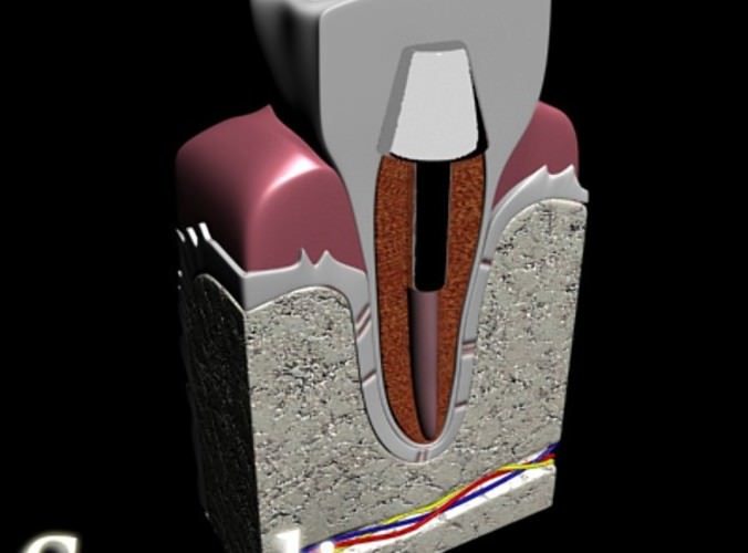 Dental Implant 3D Model .max .obj .3ds .fbx