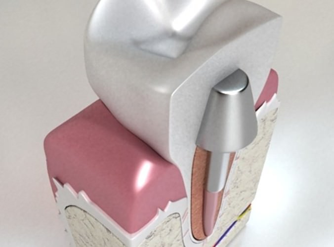 Dental Implant 3D Model .max .obj .3ds .fbx