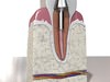 Dental Implant 3D Model