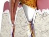 Tooth Dental Plaque High Detail 3D Model .max .obj .3ds .fbx