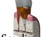 Tooth Dental Plaque High Detail 3D Model .max .obj .3ds .fbx