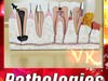 Teeth Pathologies High Detail 3D Model