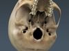 Human Female Anatomy - Body, Muscles, Skeleton, Internal Organs and Lymphatic 3D Model .max .obj .3ds .fbx .lwo .lw .lws .c4d