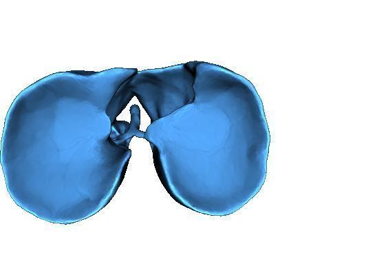 Human Lungs 3D print model_3