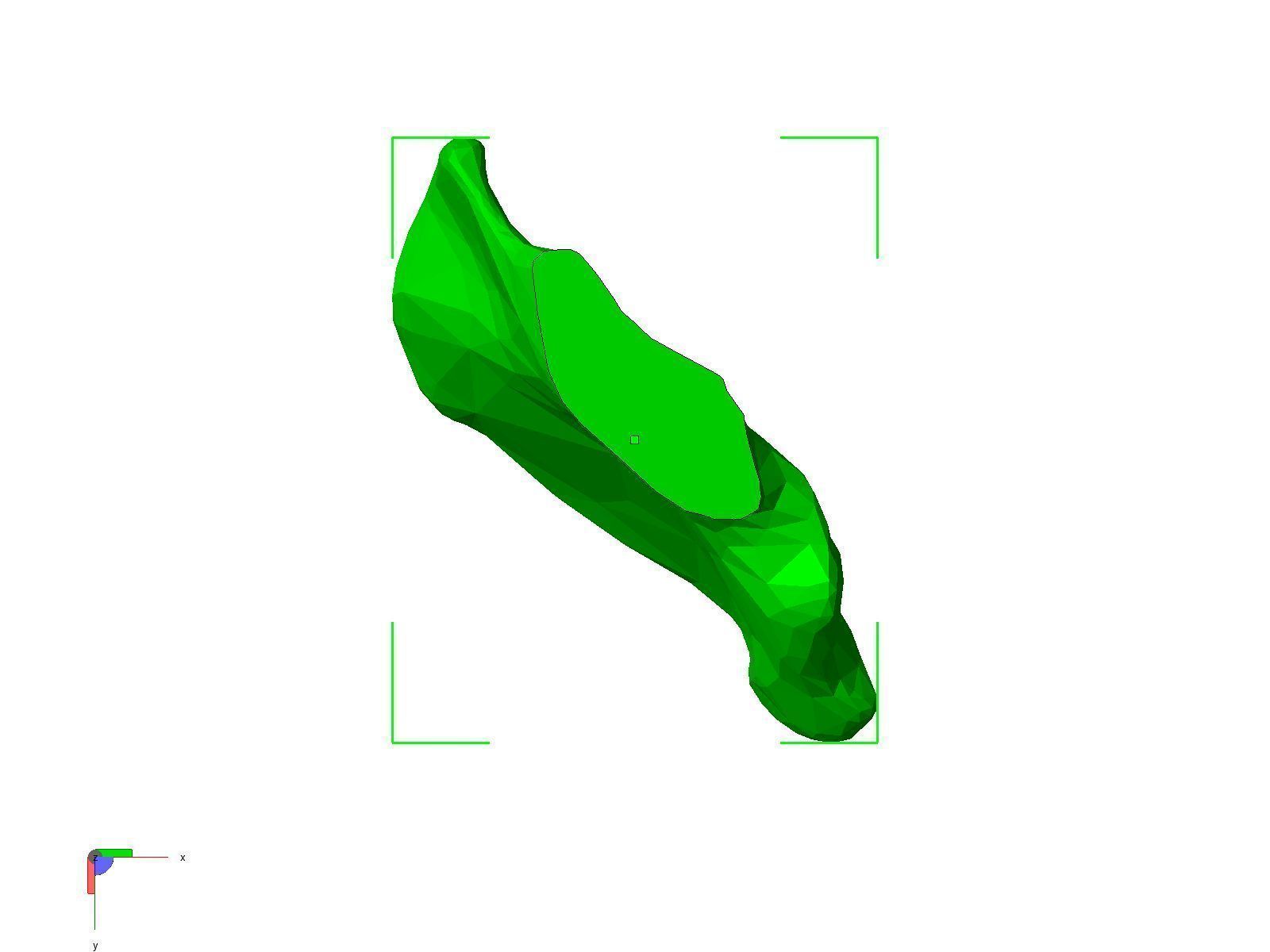 Human Hip Bone-Right two pieces 3D print model_2