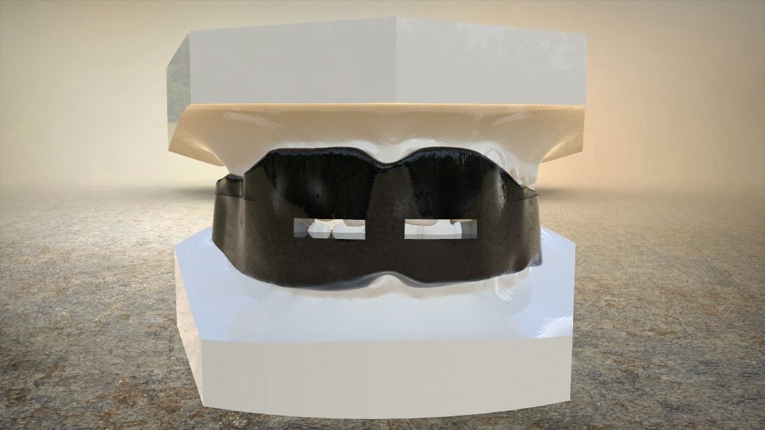 Digital Anti-snoring Mouthguard 3D print model_7