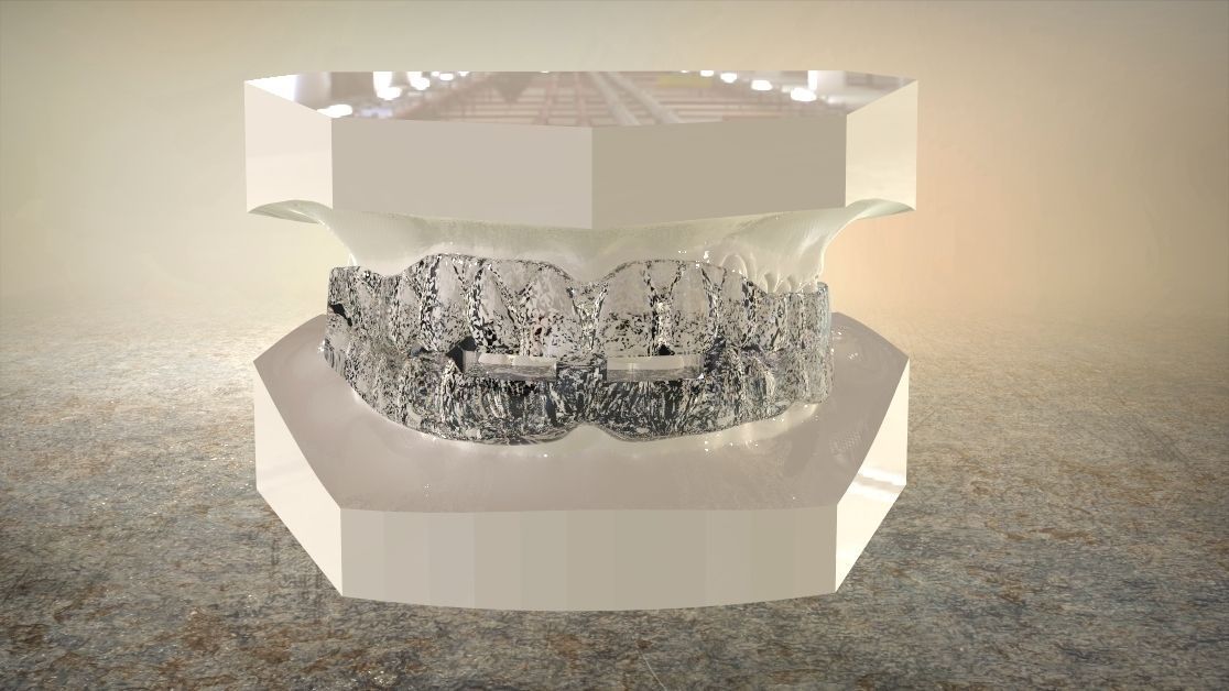 Digital Anti-snoring Mouthguard 3D print model_6