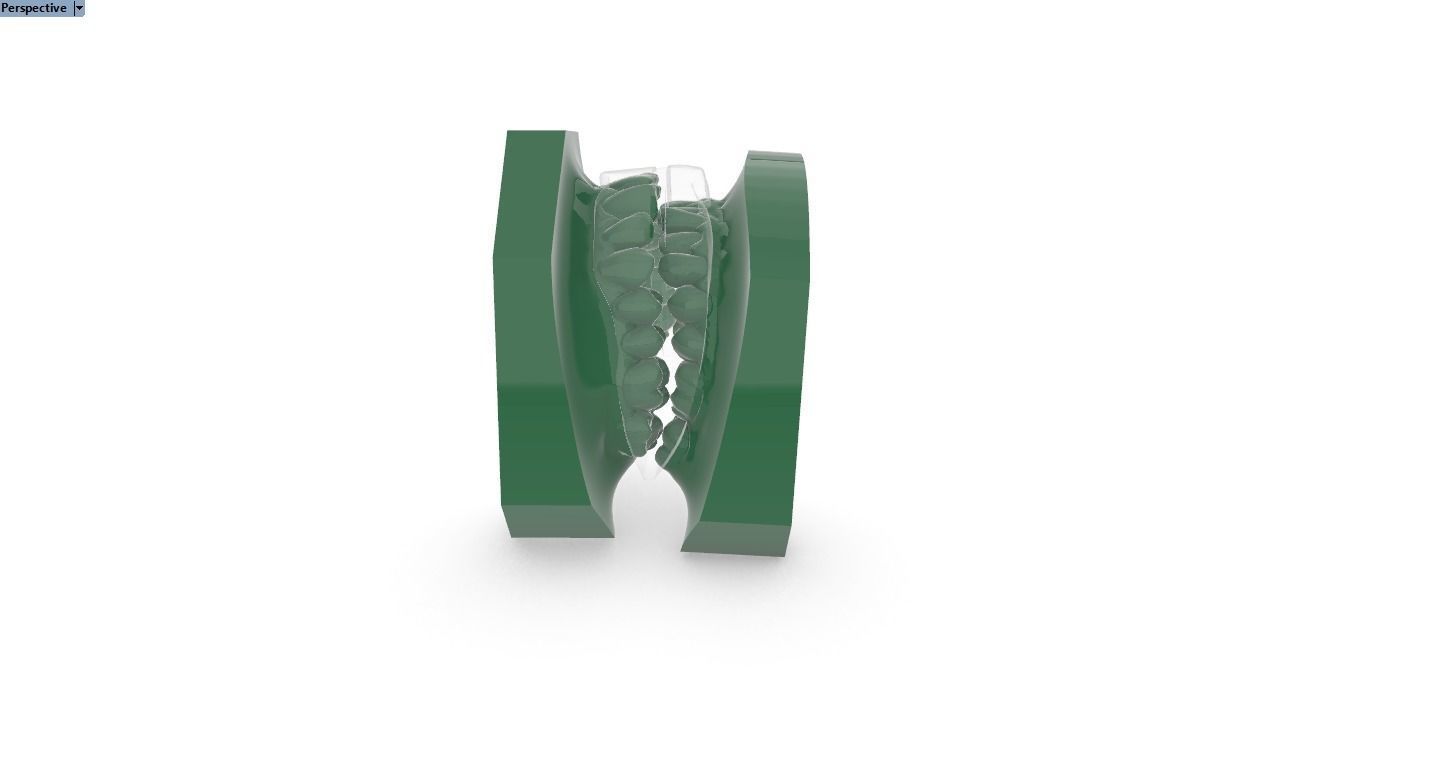 Digital Anti-snoring Mouthguard 3D print model_4