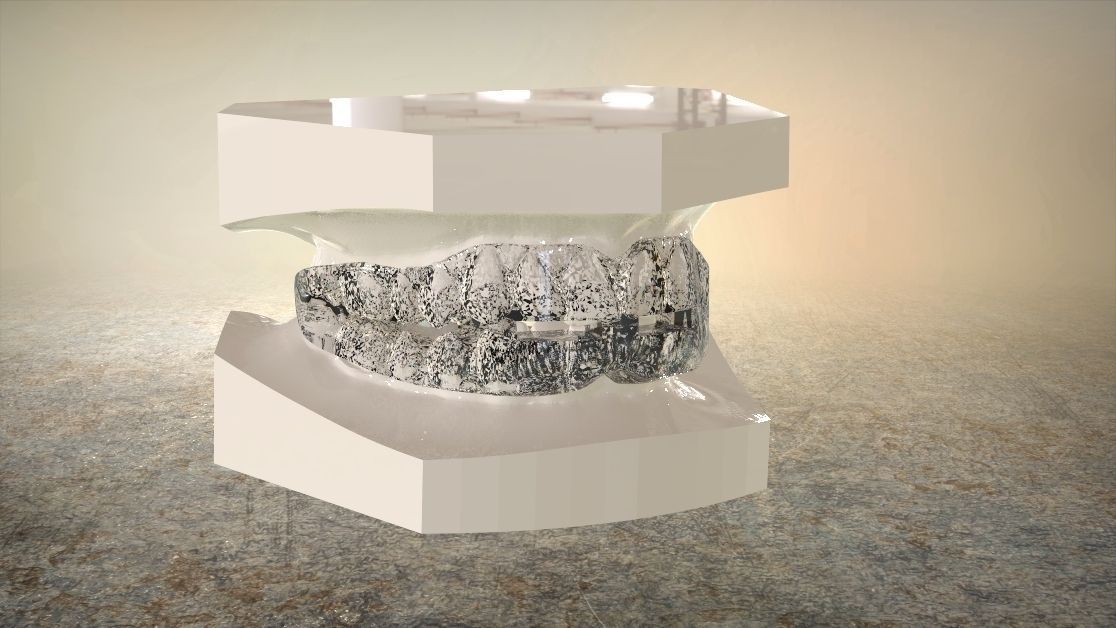 Digital Anti-snoring Mouthguard 3D print model_13