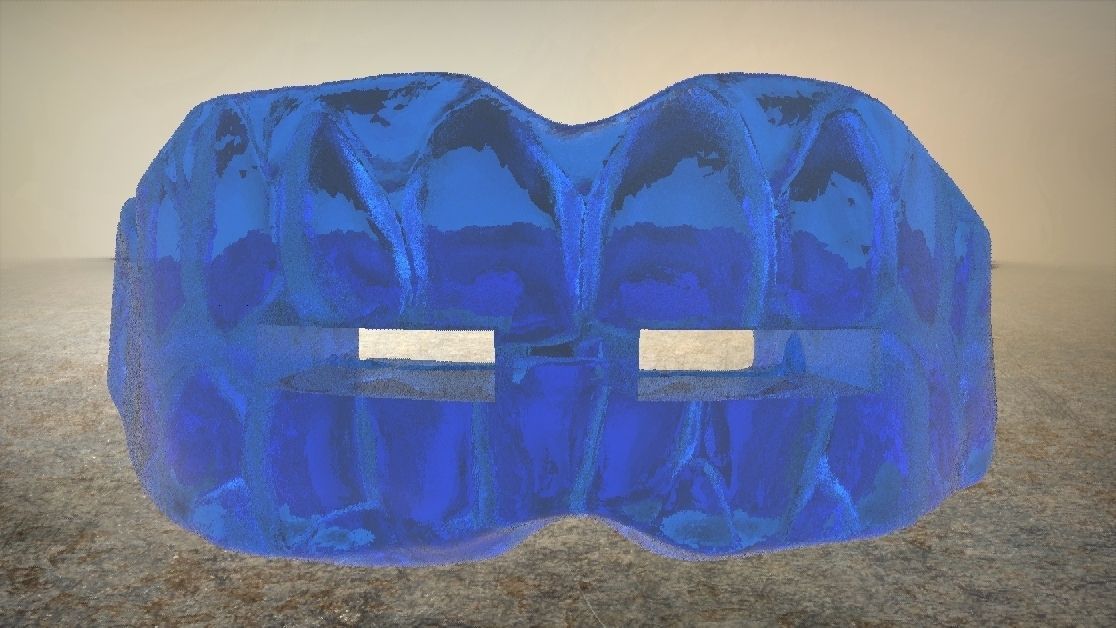 Digital Anti-snoring Mouthguard 3D print model_10