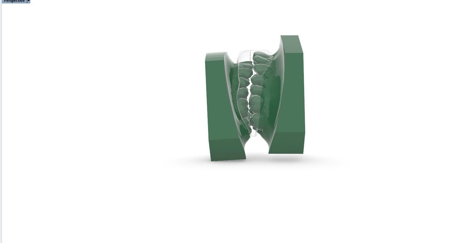 Digital Anti-snoring Mouthguard 3D print model_5