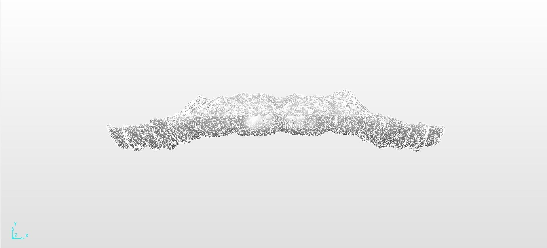 Digital Upper Overlay Hard Splint 3D print model_10