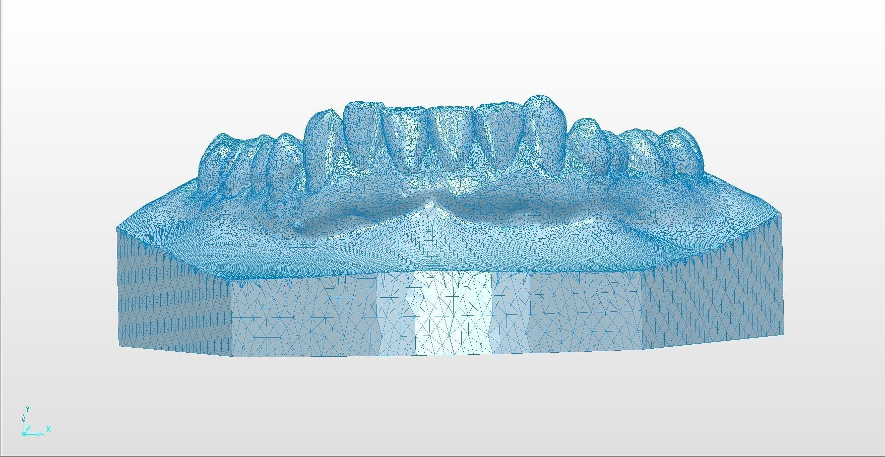 Digital Upper Overlay Hard Splint 3D print model_9