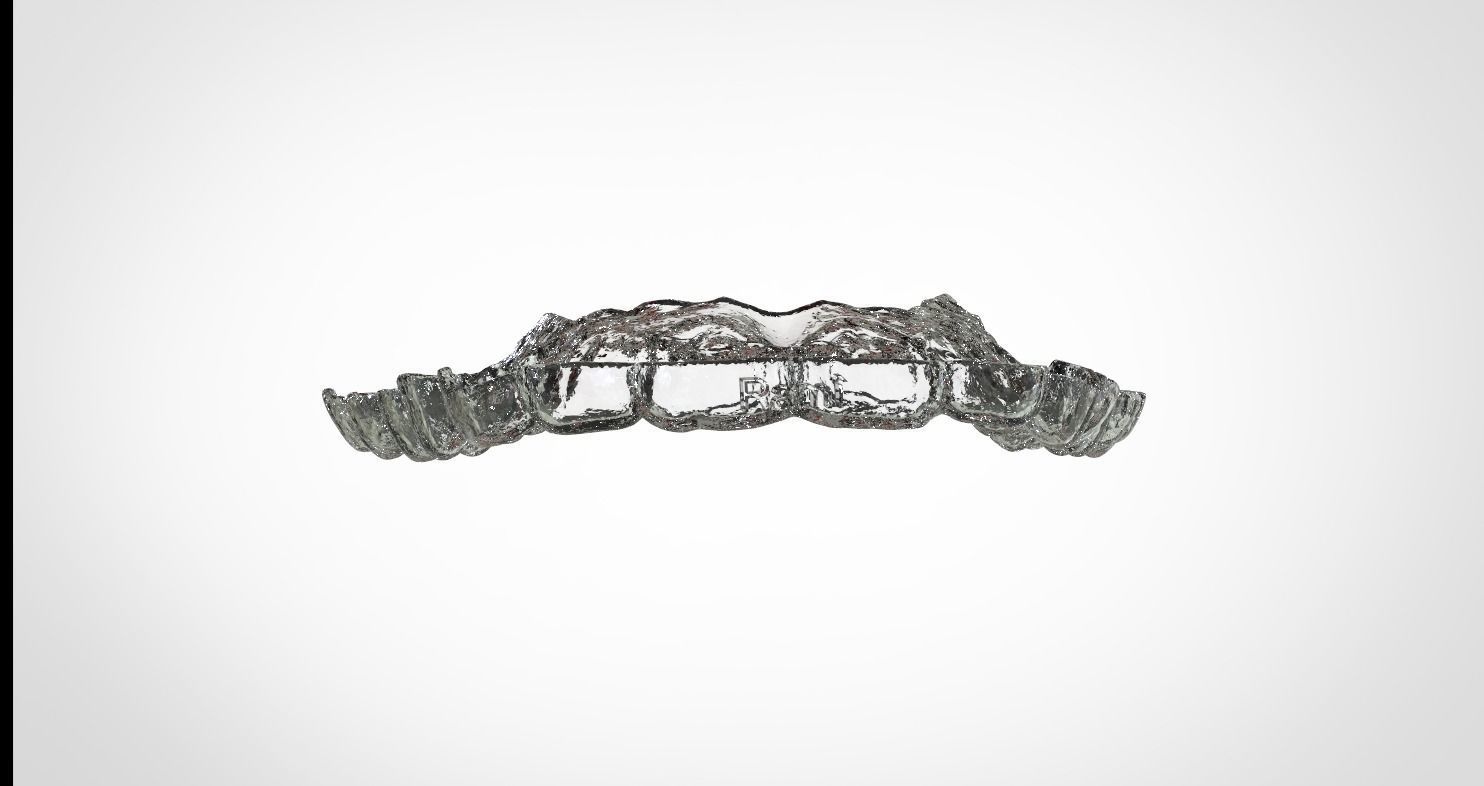 Digital Upper Overlay Hard Splint 3D print model_6