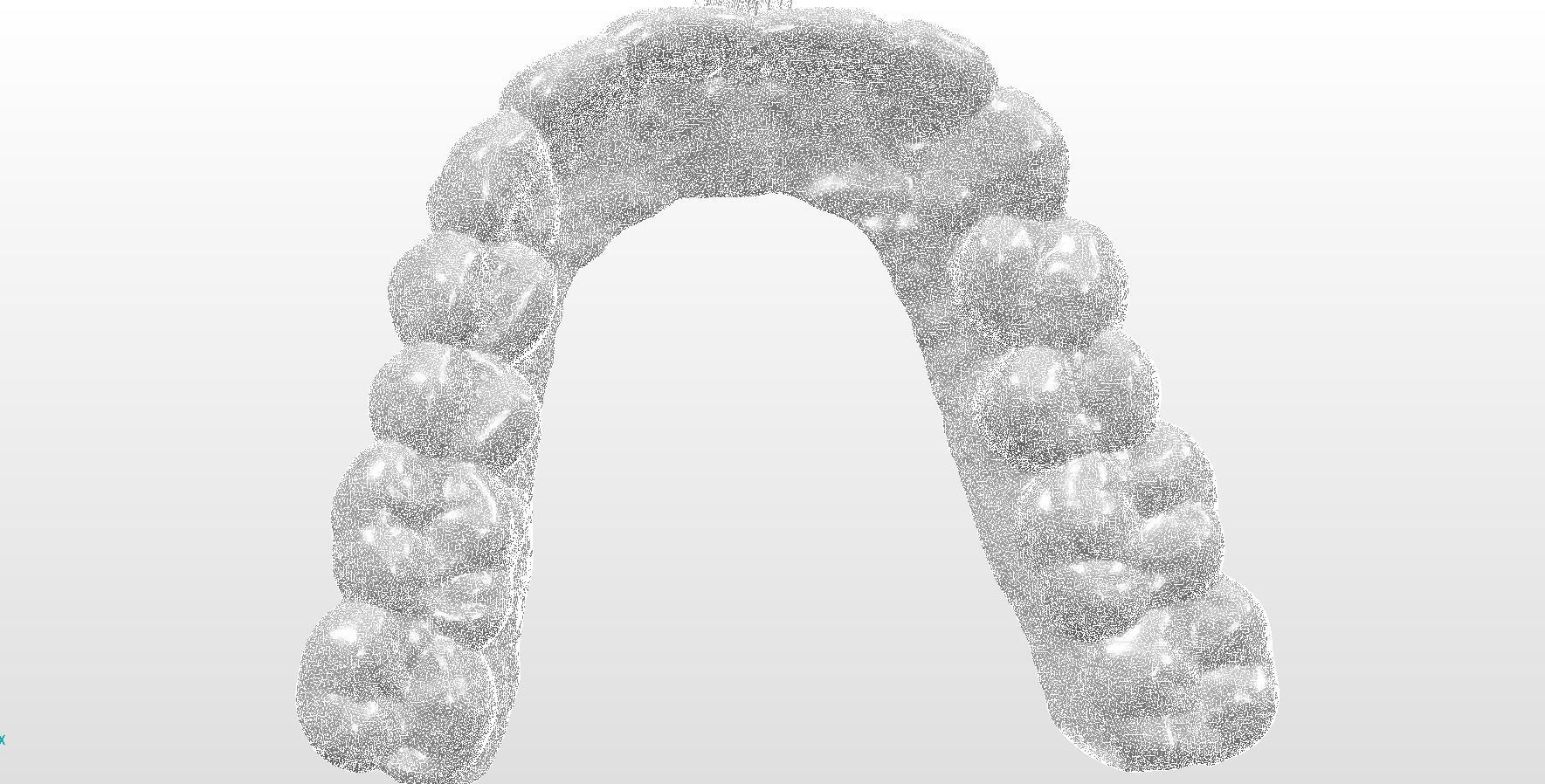 Digital Upper Overlay Hard Splint 3D print model_11