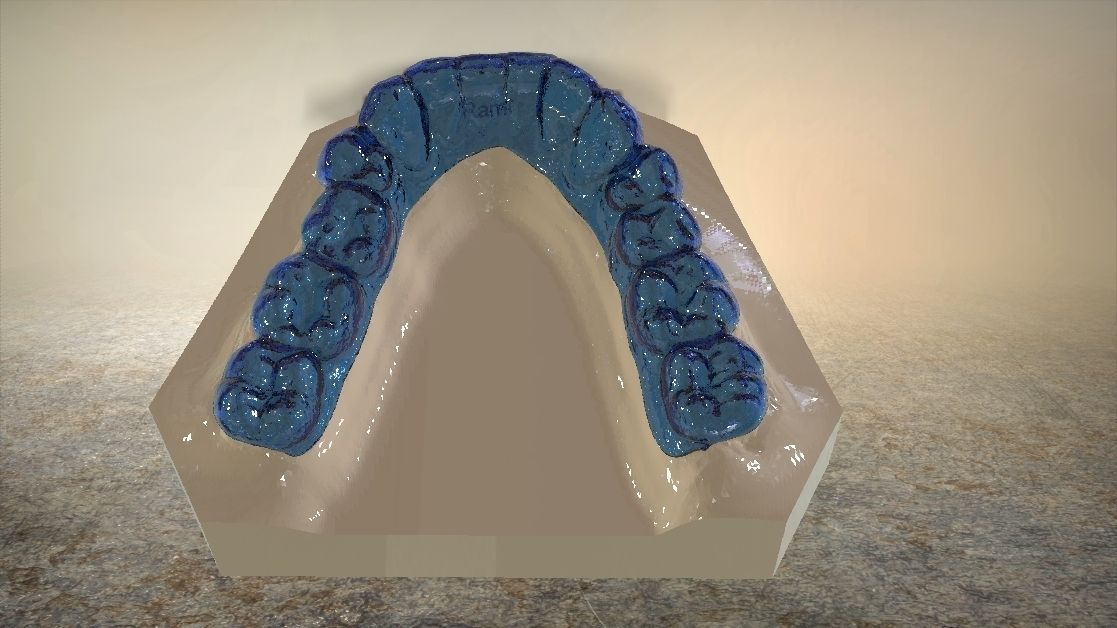 Digital Dental Lower Overlay Hard Splint 3D print model_9