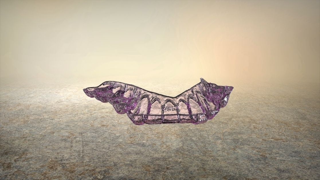 Digital Dental Lower Overlay Hard Splint 3D print model_10