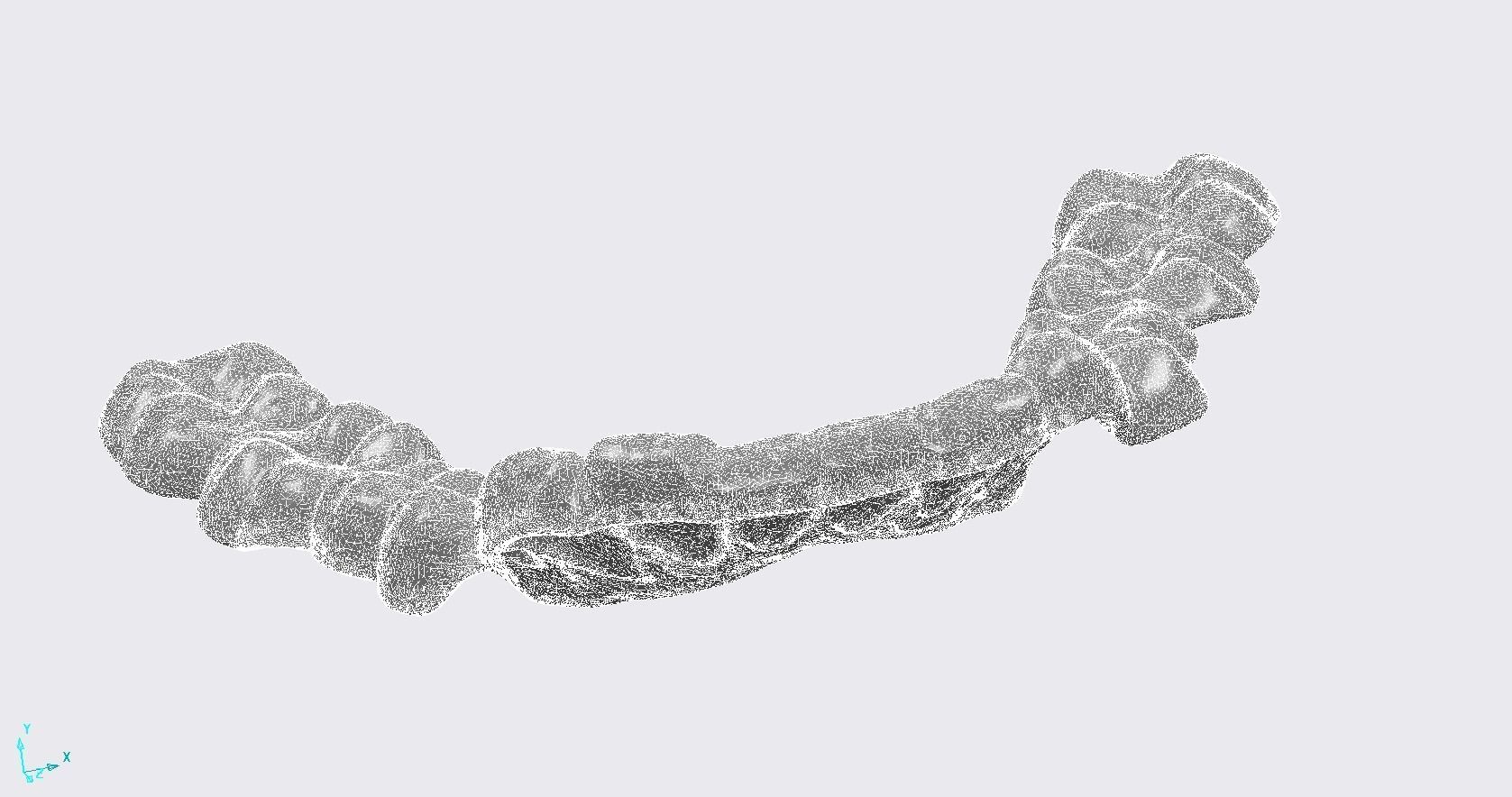 Digital Dental Lower Overlay Hard Splint 3D print model_5