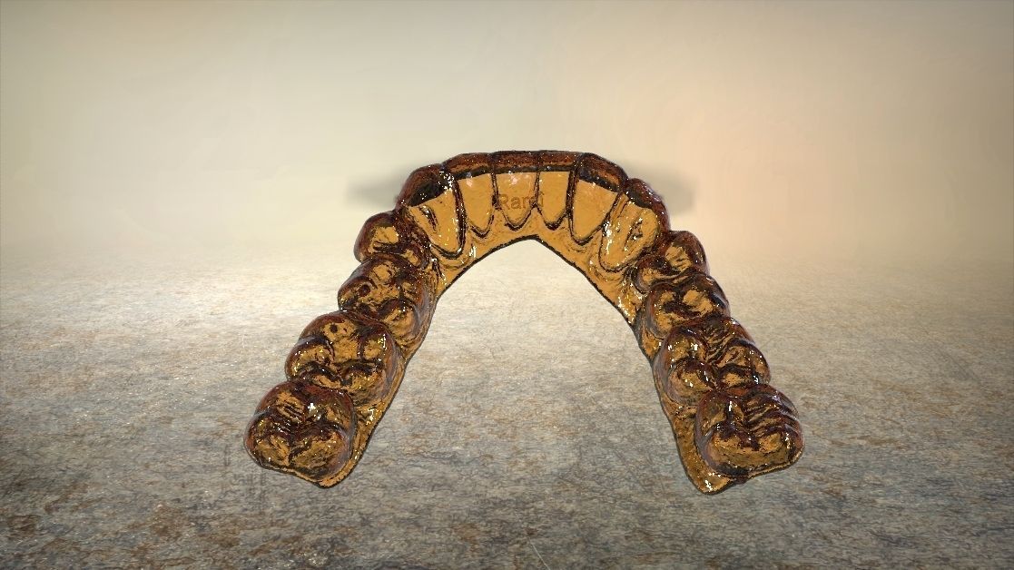 Digital Dental Lower Overlay Hard Splint 3D print model_17