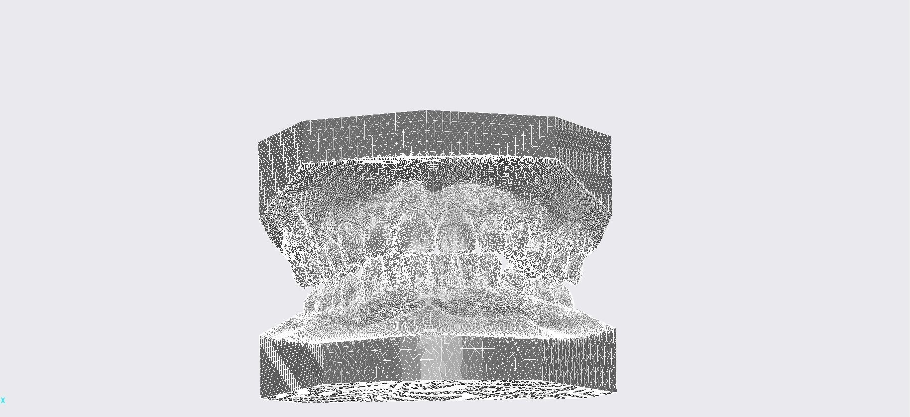 Digital Dental Lower Overlay Hard Splint 3D print model_6