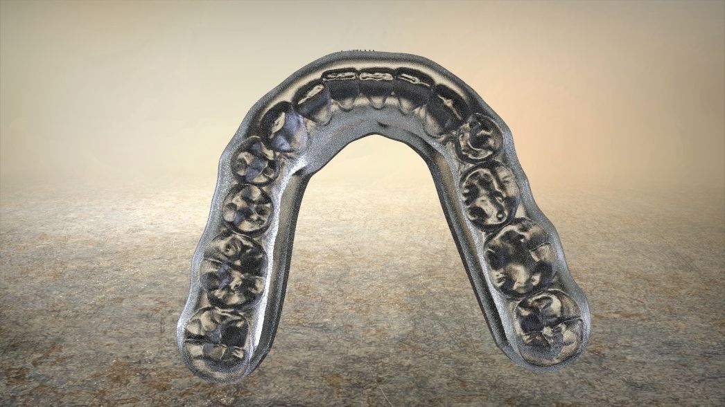 Double and Hybrid Night Guard Splints 3D print model_4