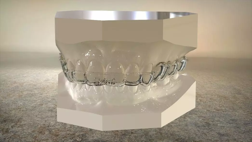 Double and Hybrid Night Guard Splints 3D print model_0