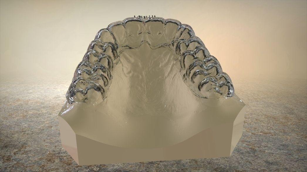 Double and Hybrid Night Guard Splints 3D print model_10