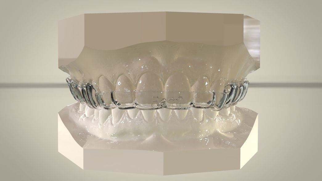 Double and Hybrid Night Guard Splints 3D print model_7