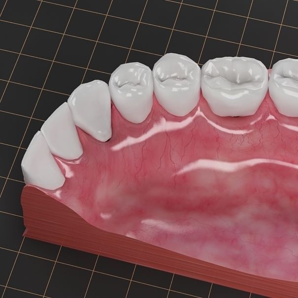 Dental Implant Collection 3D model_9
