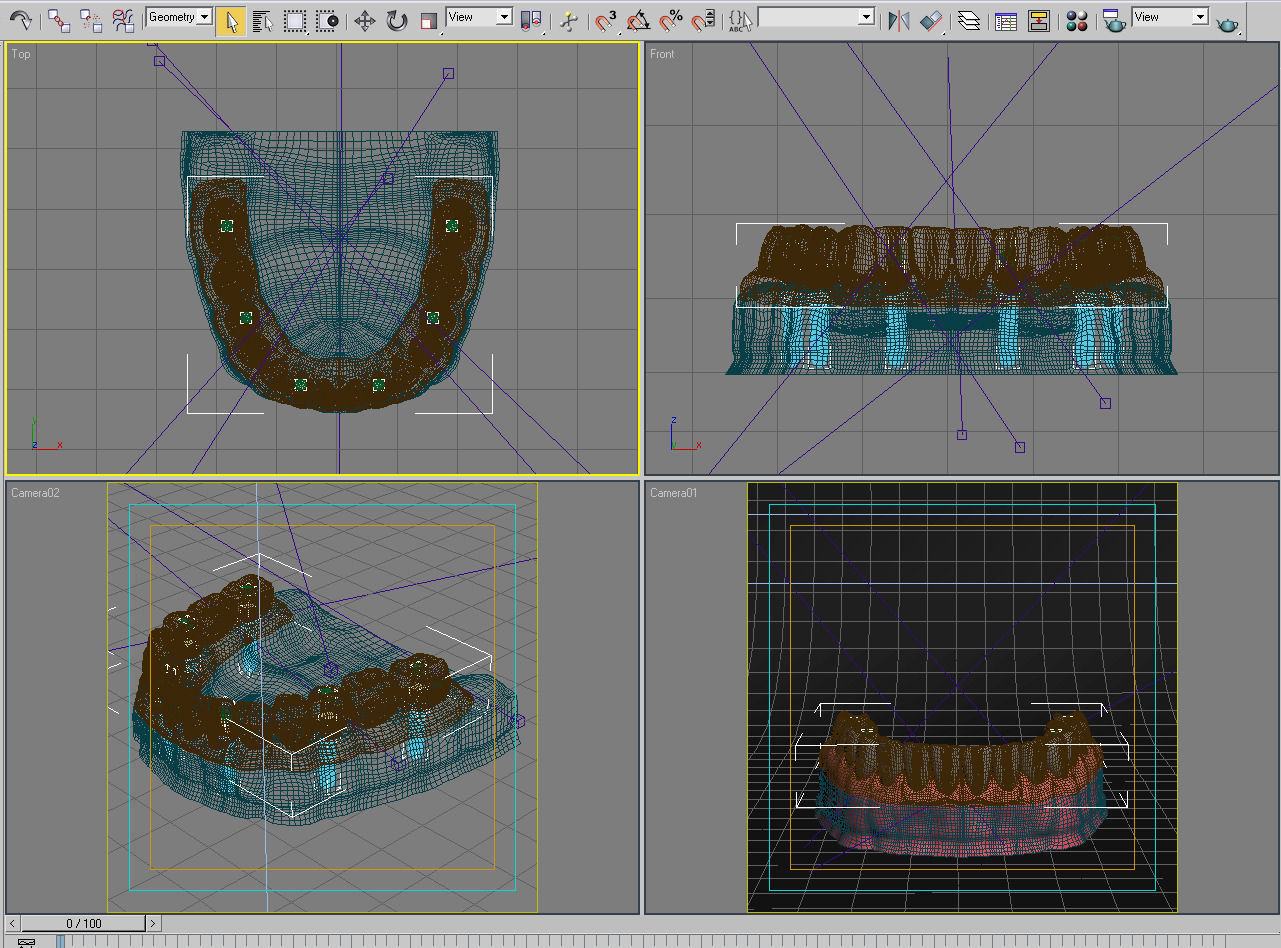 Dental Implant Collection 3D model_25
