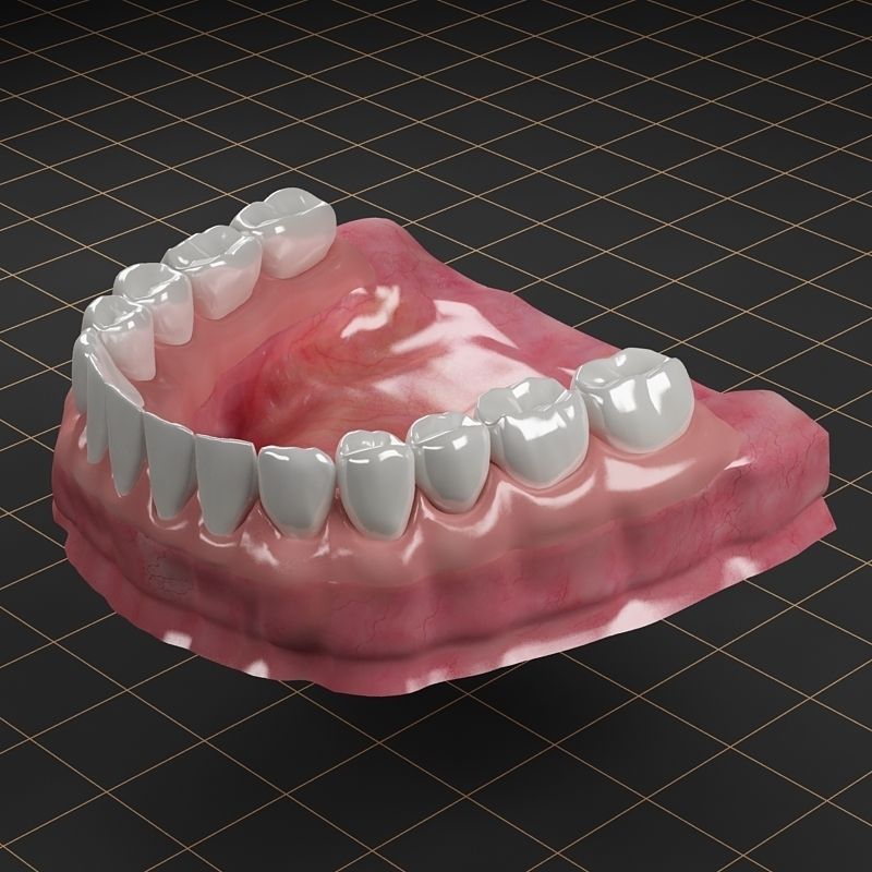 Dental Implant Collection 3D model_20