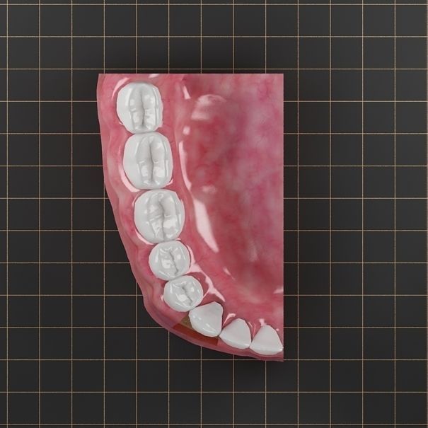 Dental Implant Collection 3D model_7