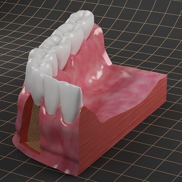 Dental Implant Collection 3D model_3