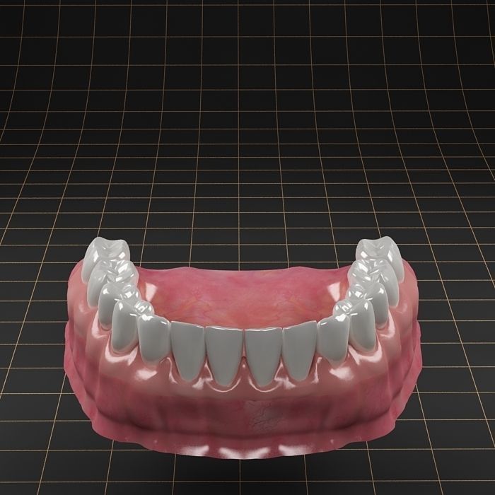 Dental Implant Collection 3D model_15