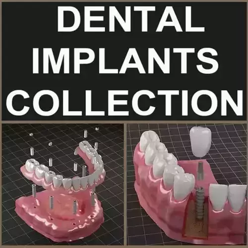 Dental Implant Collection 3D model