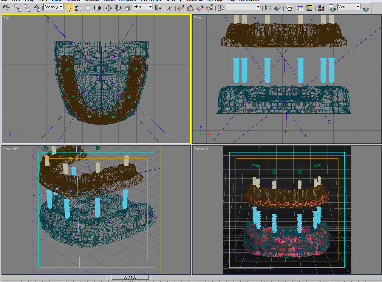 Dental Implant Collection 3D model_24