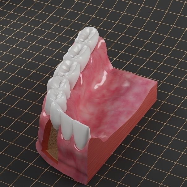Dental Implant Collection 3D model_6