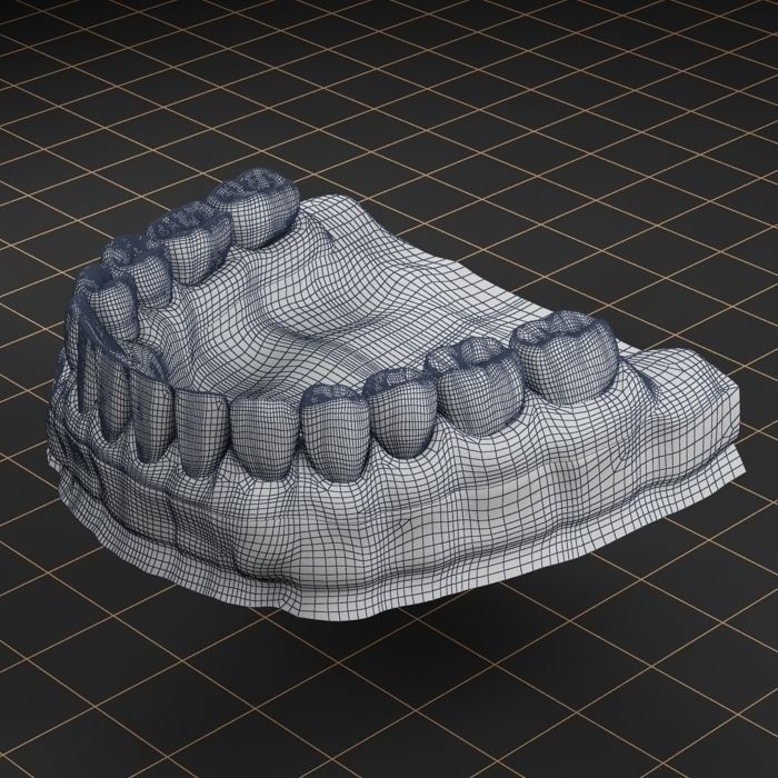 Dental Implant Collection 3D model_21
