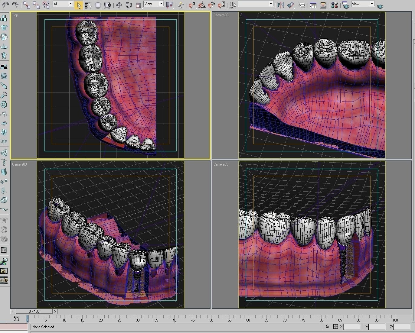 Dental Implant Collection 3D model_14