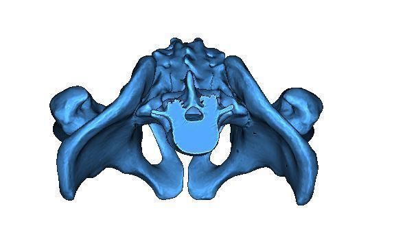 Human Pelvis 3D print model_5