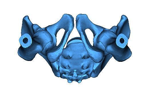 Human Pelvis 3D print model_4
