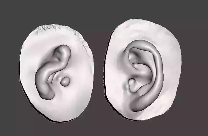 Natural ear anatomy with microtia 3D print model