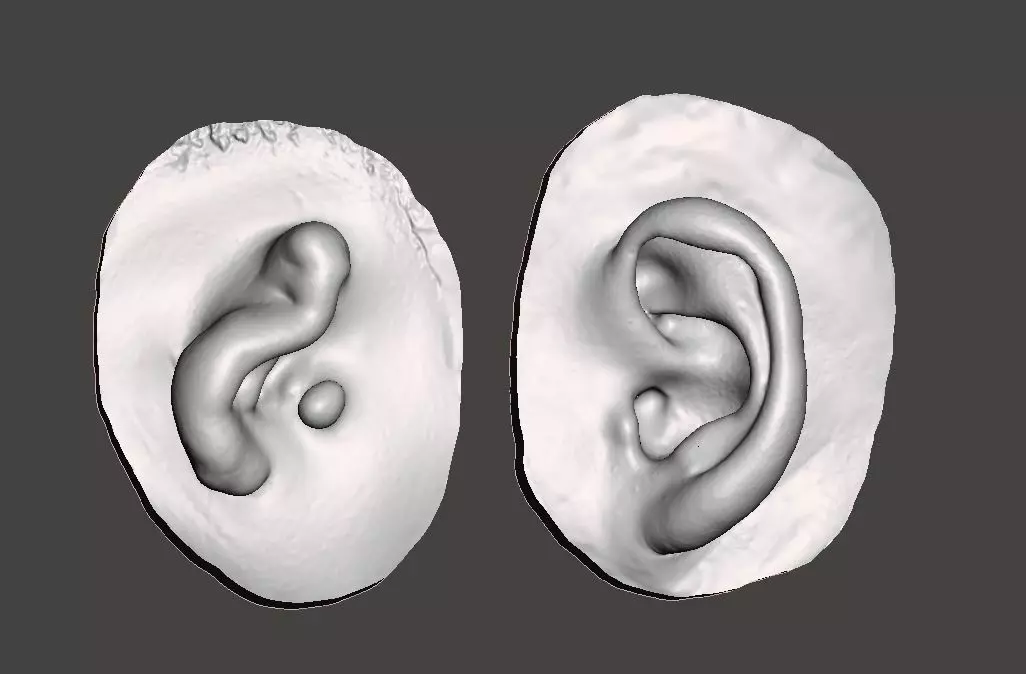 Natural ear anatomy with microtia 3D print model