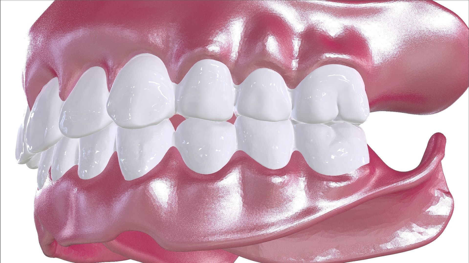 Digital Full Dentures with Combined Glue-in Teeth Arch 3D print model_18
