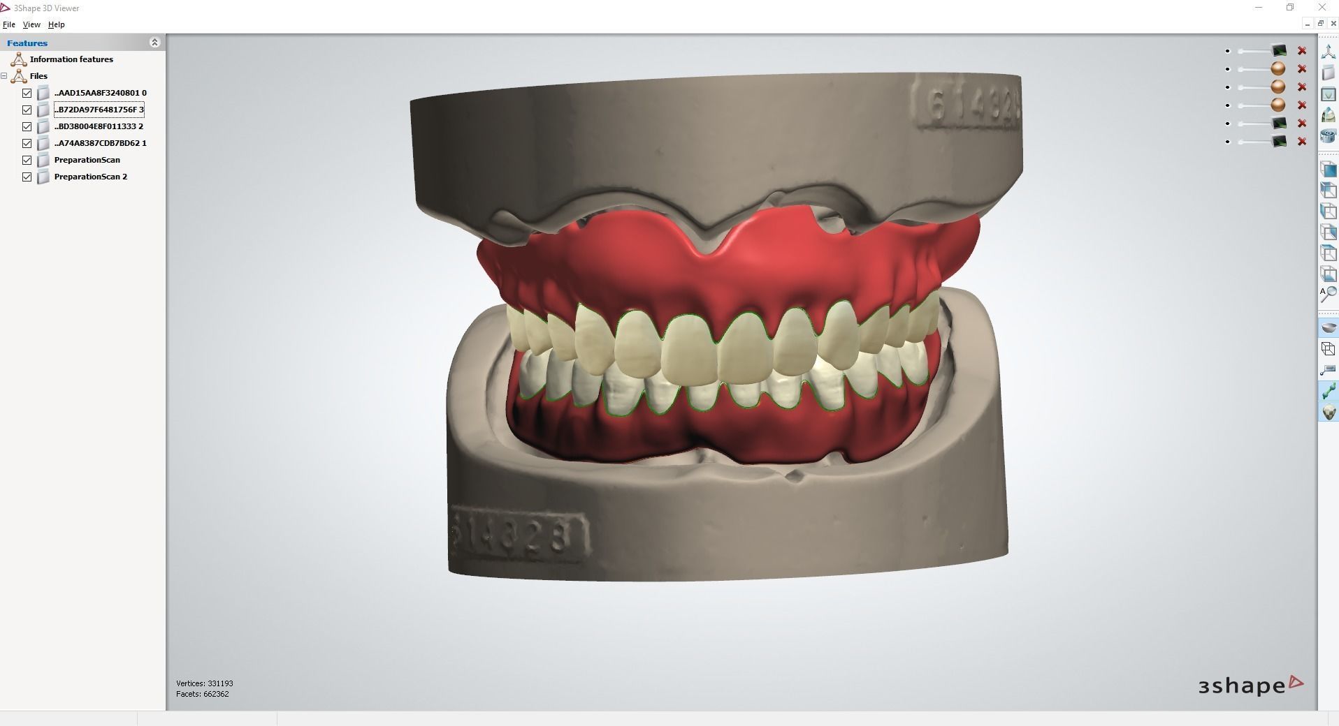 Digital Full Dentures with Combined Glue-in Teeth Arch 3D print model_13