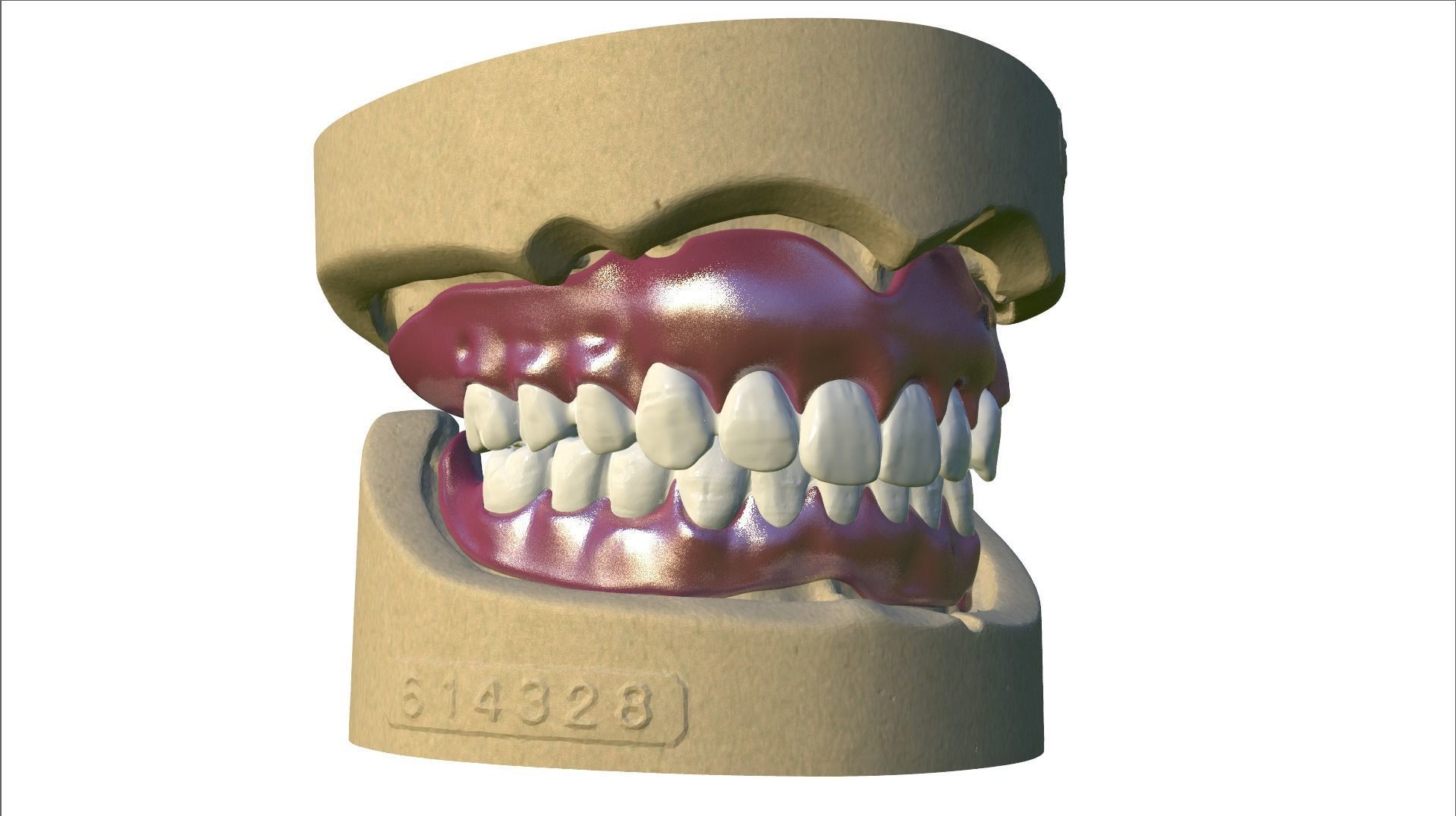 Digital Full Dentures with Combined Glue-in Teeth Arch 3D print model_9